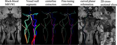 Deep Learning-Based Automated Detection of Arterial Vessel Wall and Plaque on Magnetic Resonance Vessel Wall Images